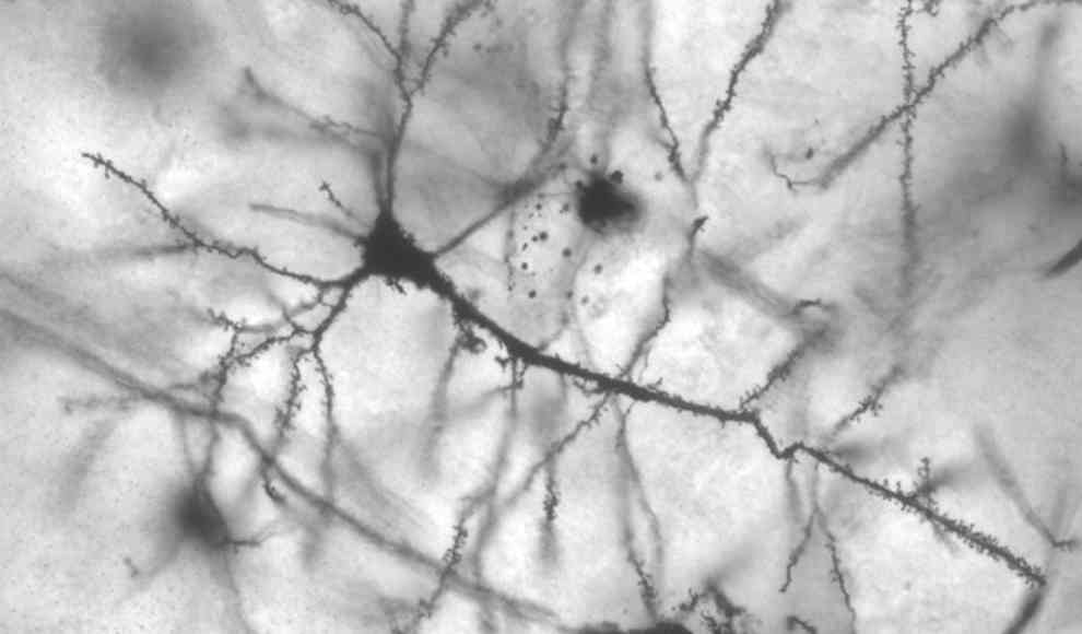 Mediziner entdecken eine neue Art menschlicher Hirnzellen