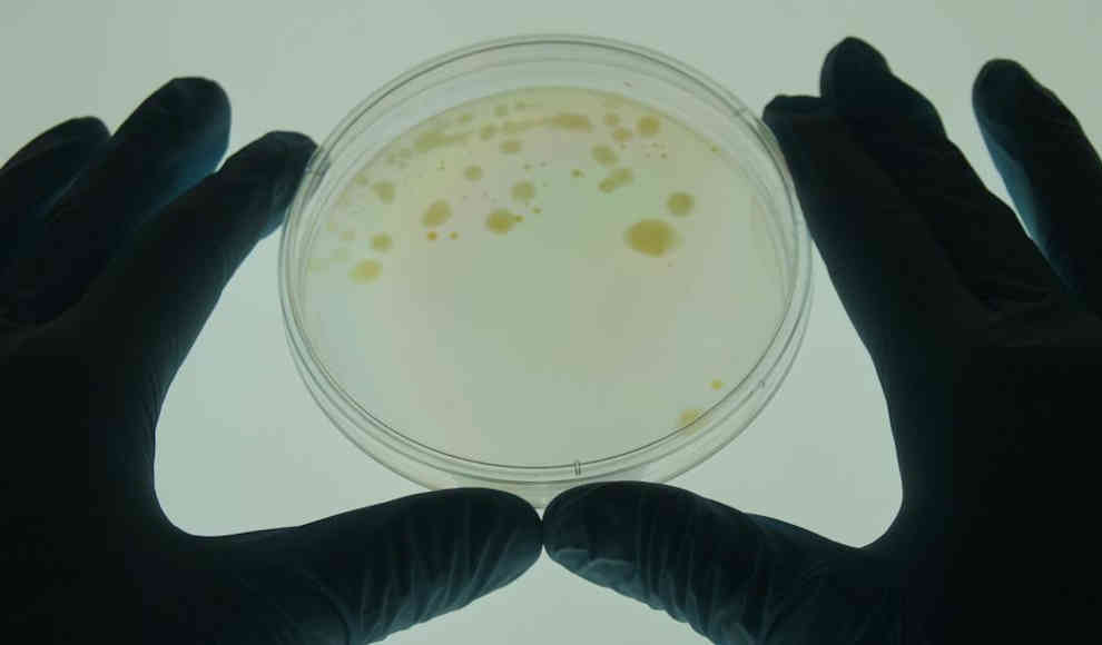 Mycobacterium vaccae