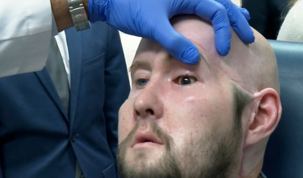 Mensch mit transplantierten Auge