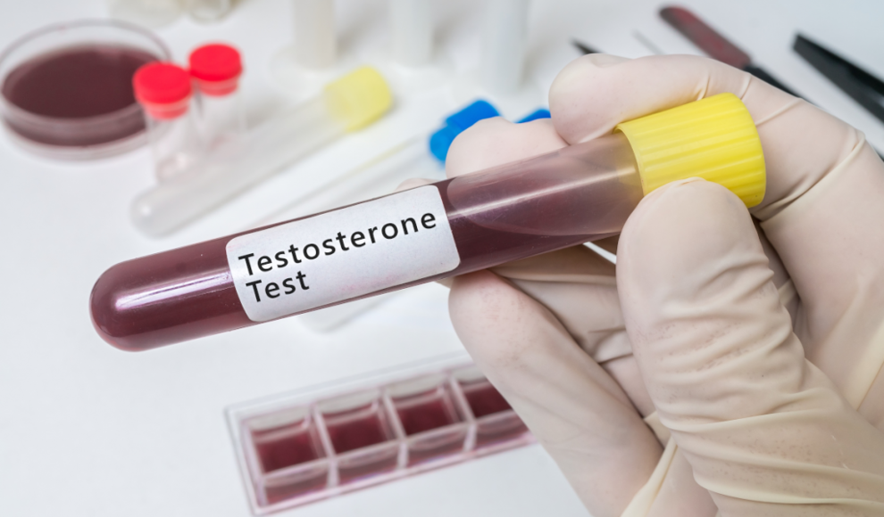 Testosteronspiegel beeinflusst Sterberisiko bei Männern