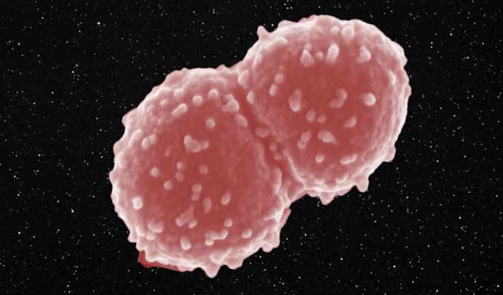 Deinococcus radiodurans