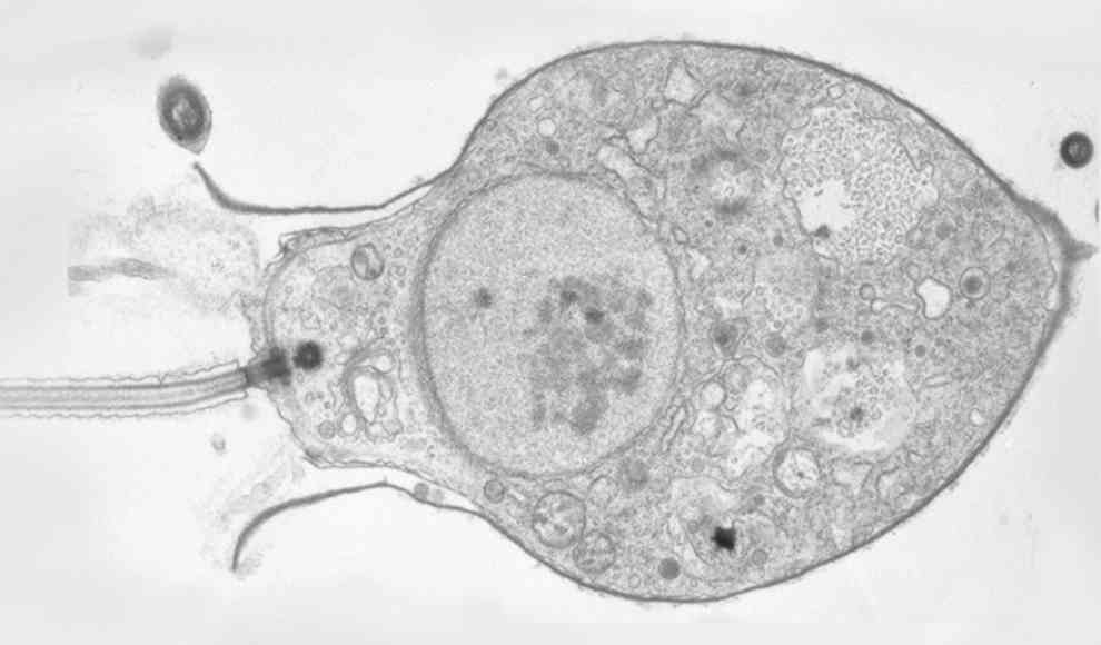 Choanoflagellaten 