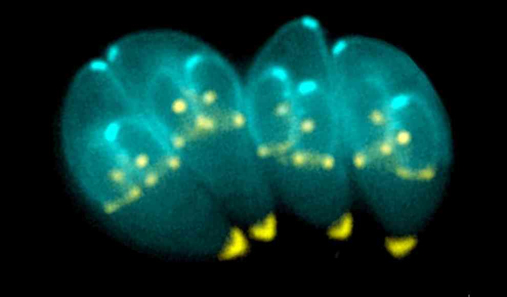 Nachcolorierte Aufnahme von vier Toxoplasmen