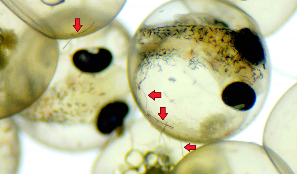 Fisch-Embryonen in einer mit Mikroplastikfasern belasteten Eihülle 