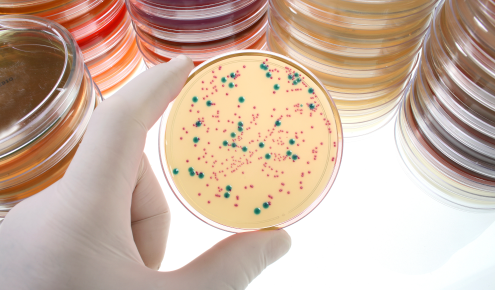Bakterien mit DNA von Viren in Petrischalen