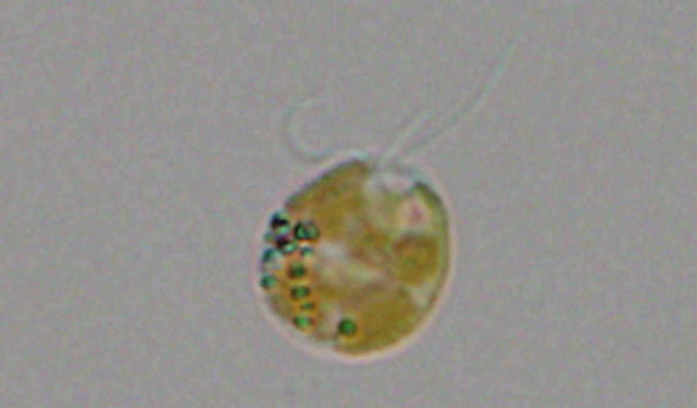 Eine Zelle der toxinhaltigen Goldalge (Prymnesium parvum)