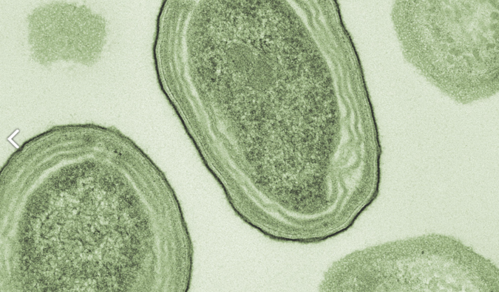 Prochlorococcus ist das kleinste, zugleich häufigste photosynthetische Plankton der Erde