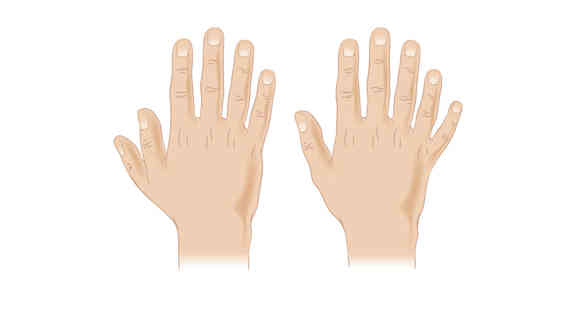 Menschen mit Polydaktylie sind klar im Vorteil