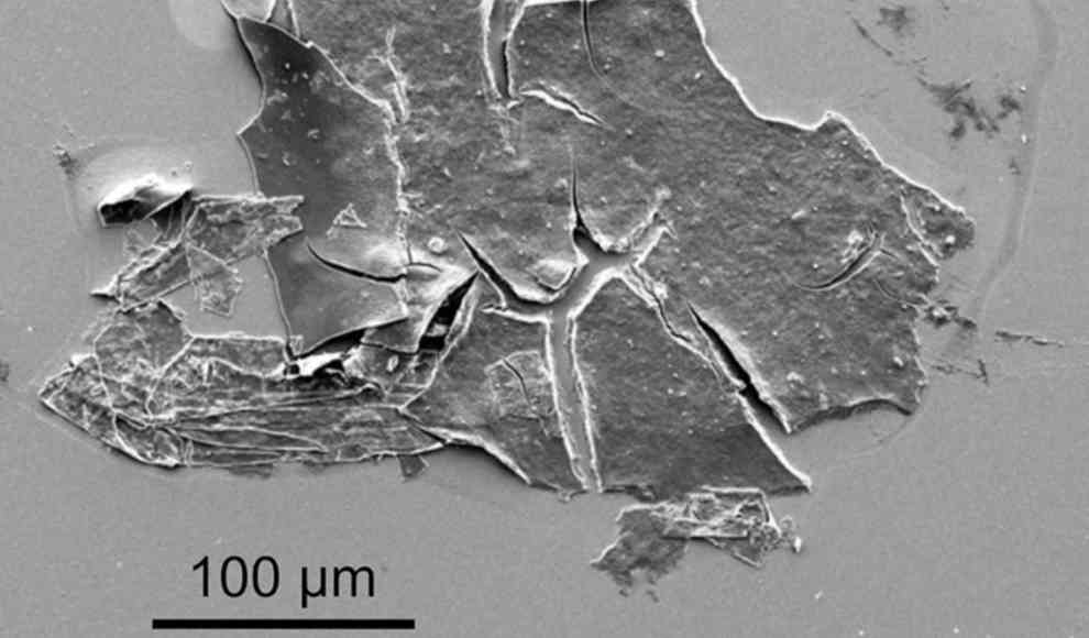 Nanogewebe unter dem Rasterelektronenmikroskop 