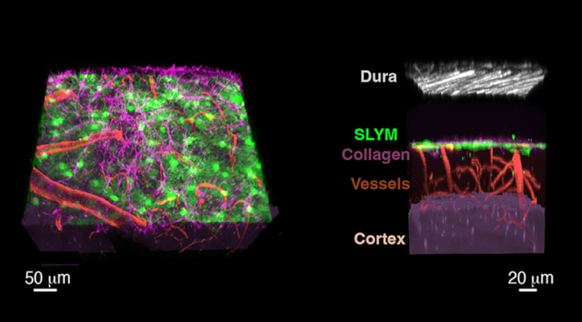 El descubrimiento de una nueva estructura cerebral