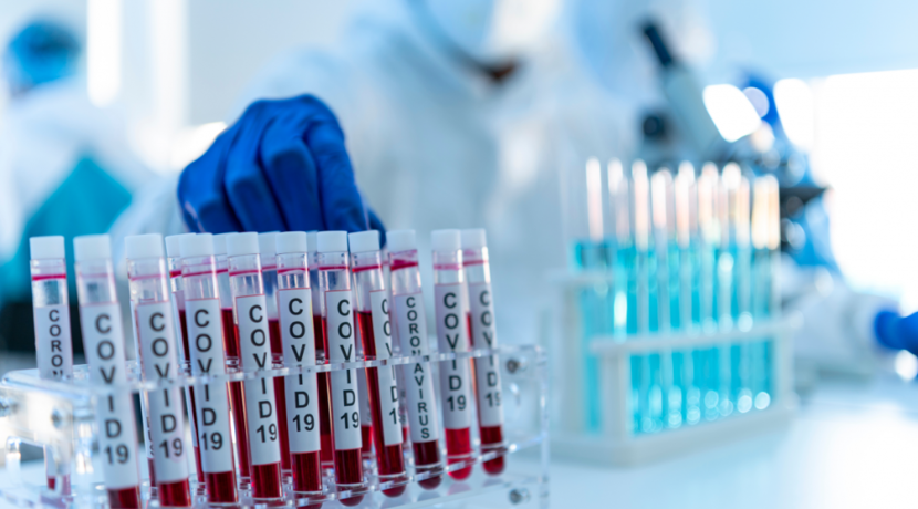 K-nstliche-Intelligenz-beschleunigt-Entwicklung-von-mRNA-Impfstoffen