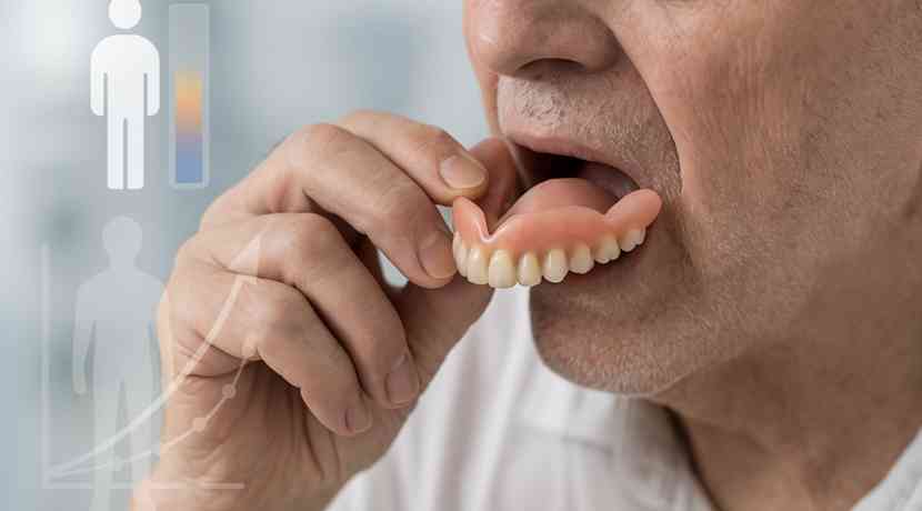 Zahnprothese-korreliert-mit-l-ngerer-Lebenszeit-bei-Senioren