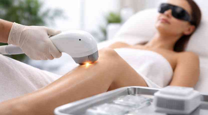 Laser-Haarentfernung-reduziert-Haarwuchs-oft-f-r-Jahre