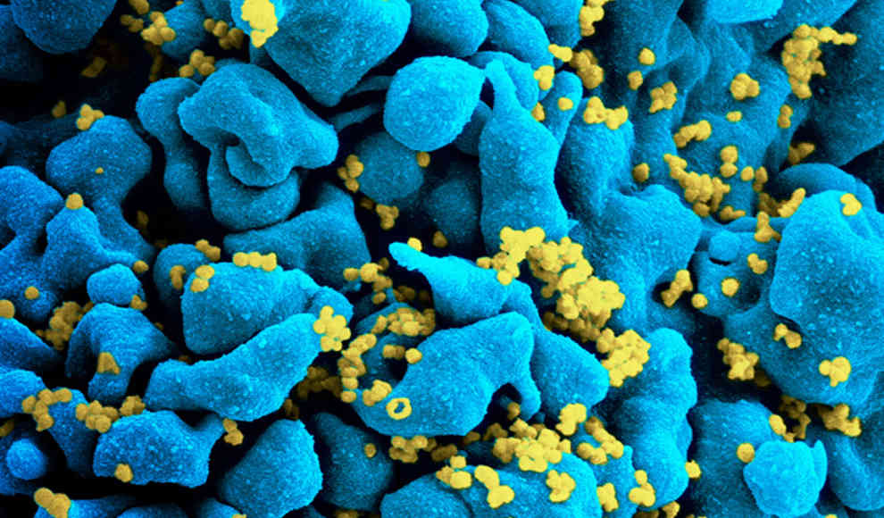 Forscher entwickeln HIV-Impfstoff
