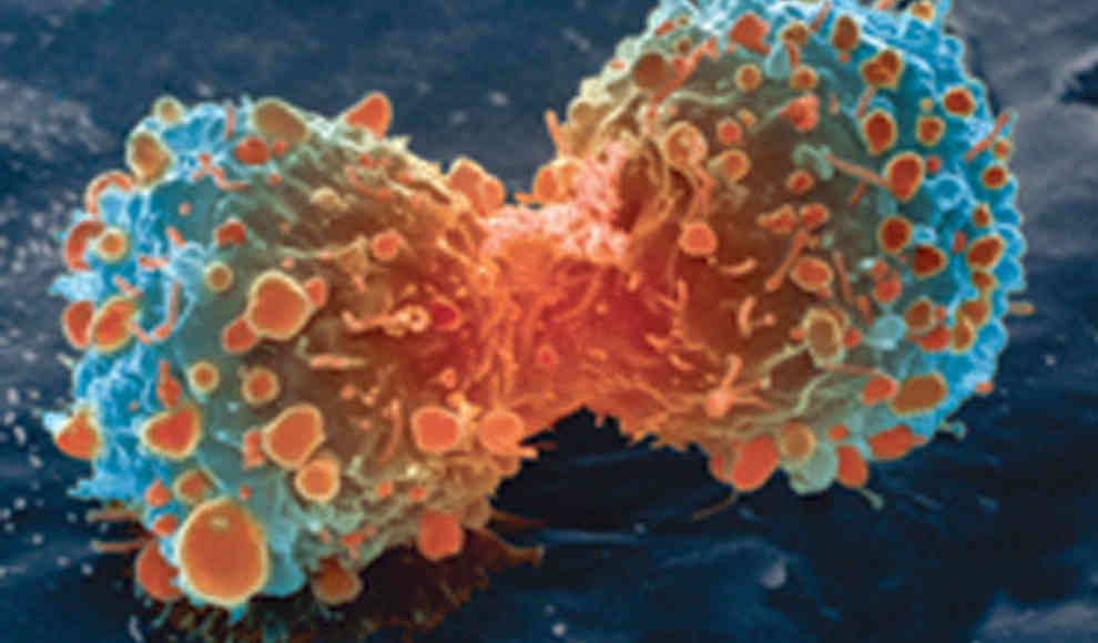 Krebsmittel zerstört Lungenkrebs vollständig