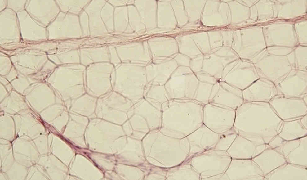Unterhautfettgewebe: Fettzellen sind ein wichtiger Teil des Immunsystems