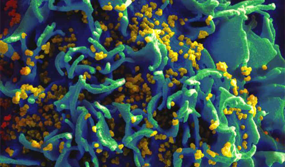 HIV-Versteck im menschlichen Körper aufgespürt