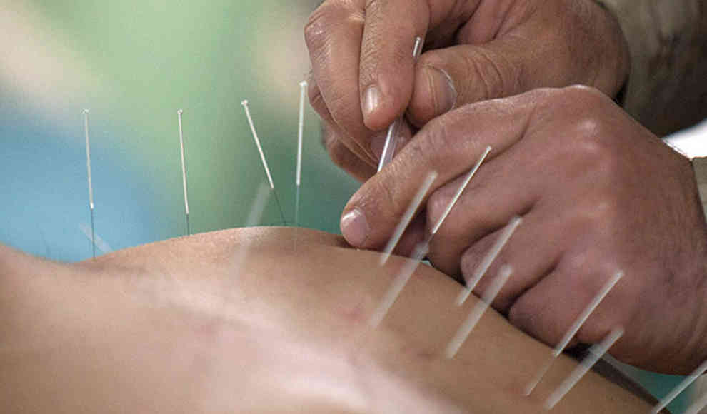 Wissenschaftler belegen biologischen Effekt von Akupunktur