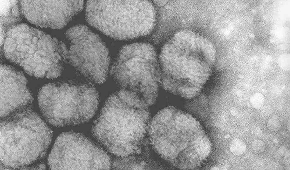 Künstlicher Pockenvirus