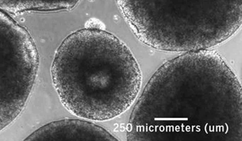 Menschliche Organoide