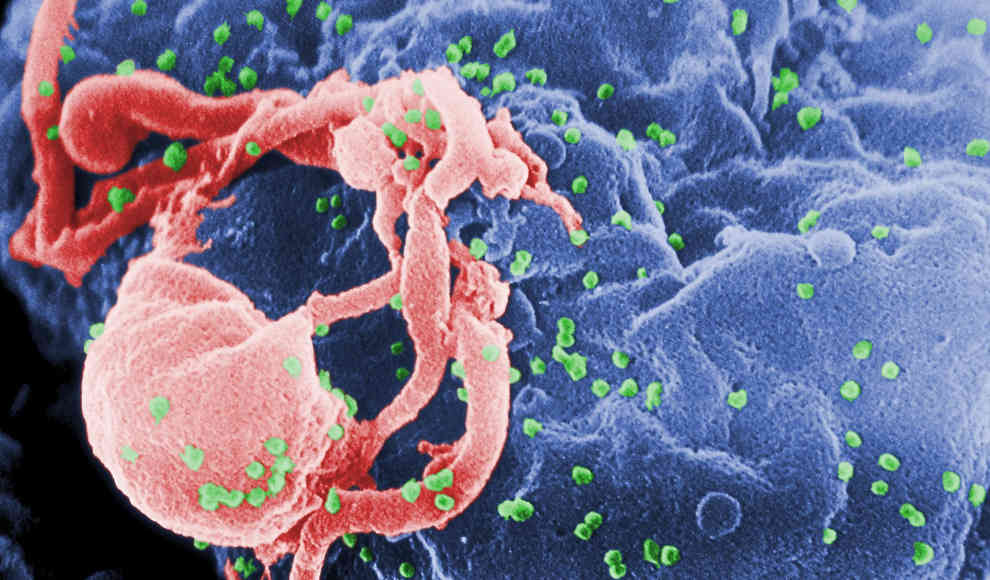 HIV-infizierte Mäuse per Genschere Crispr geheilt