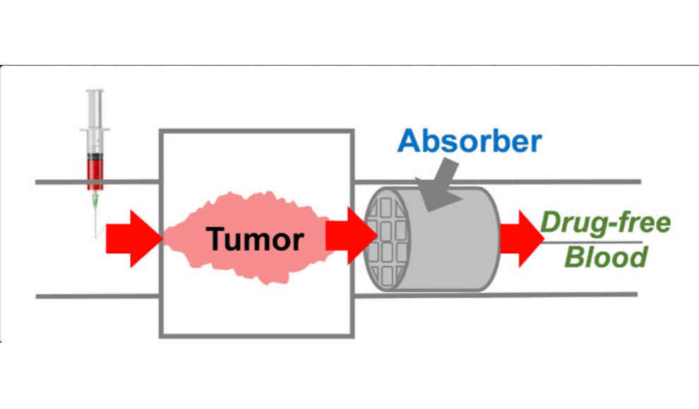 Venenimplantat filter Blut