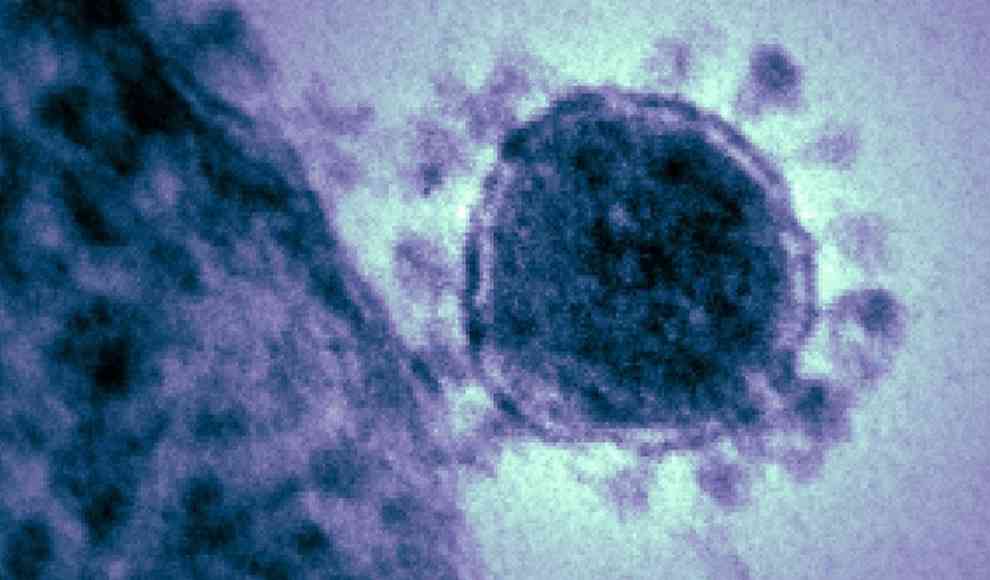 Coronavirus