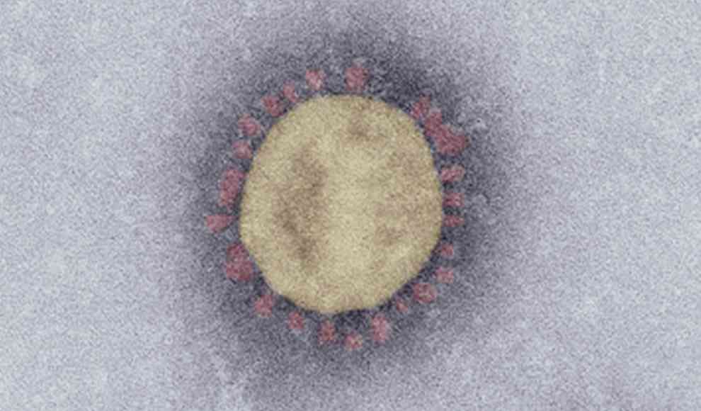 Coronavirus