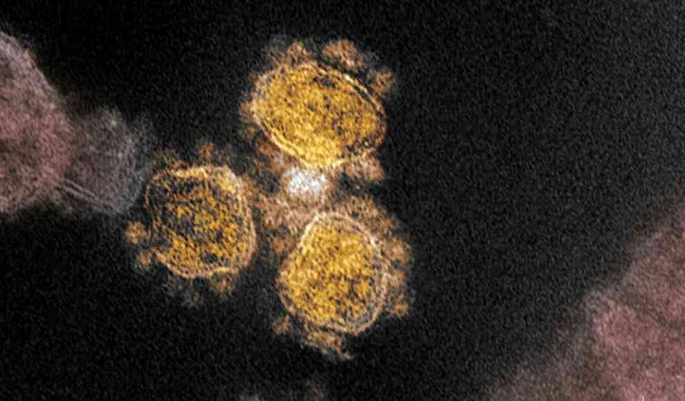 Coronavirus SARV-CoV-2 unter dem Mikroskop 