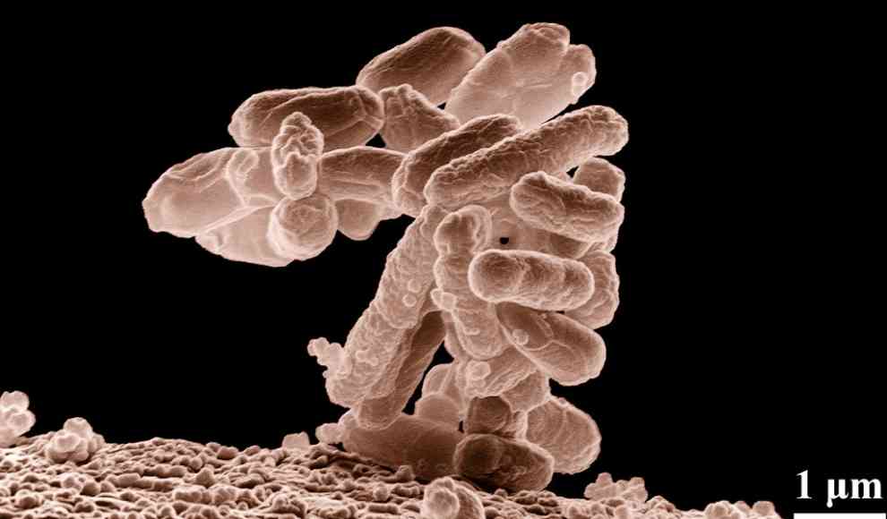 E. coli Bakterium
