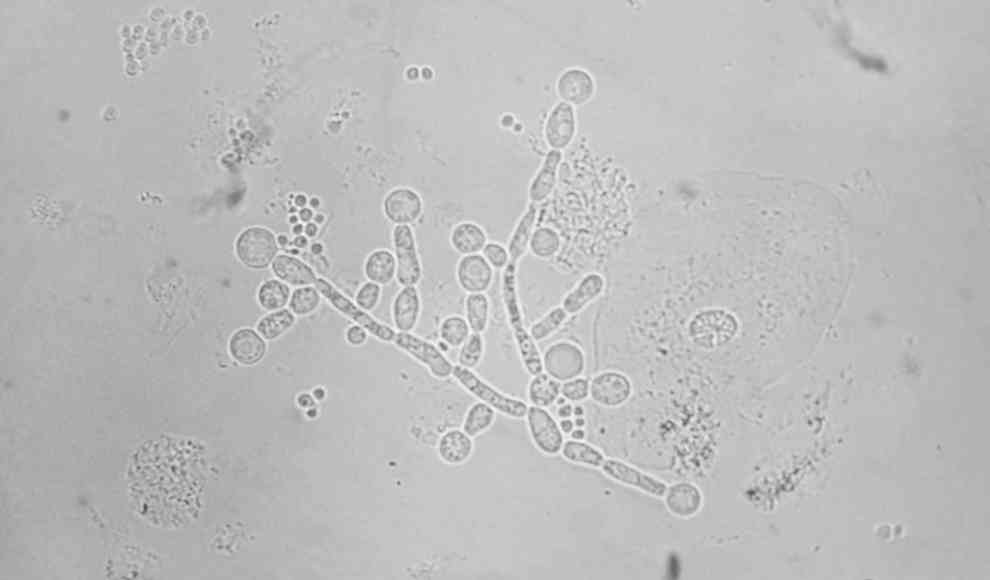 Candida albicans