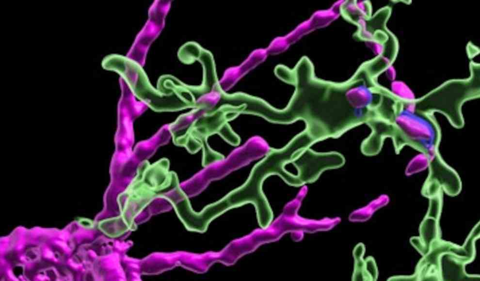 Mikroglia (grün) und das perineural Netz (magenta)