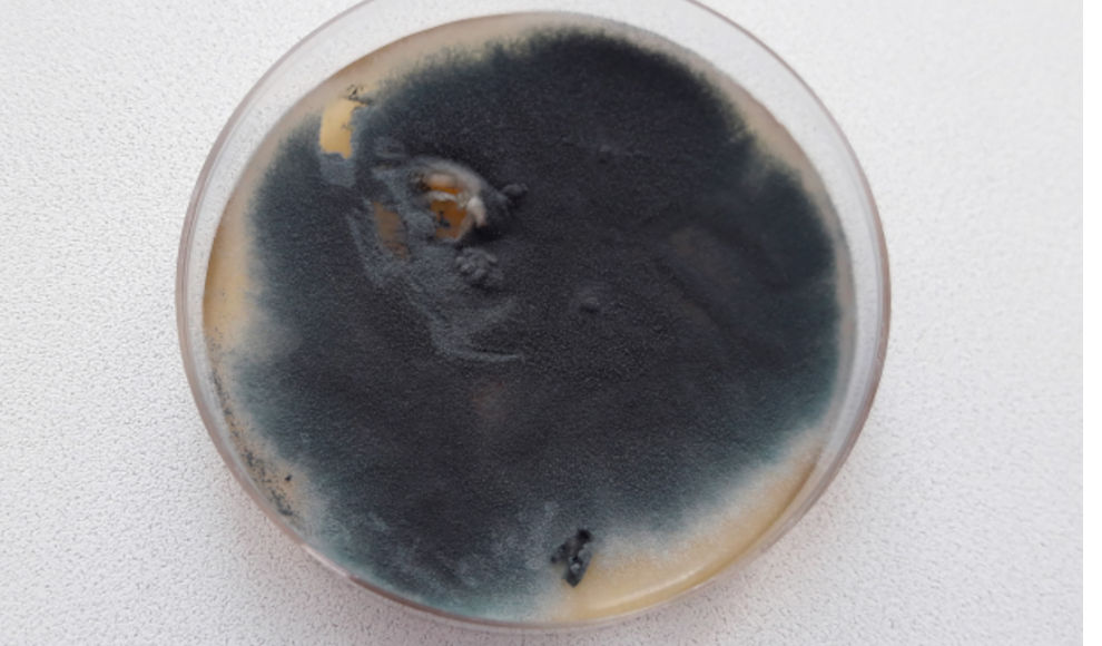 Aspergillus fumigatus