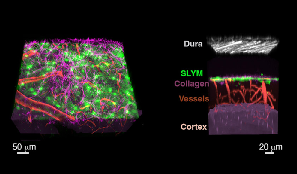 SLYM-Membran im Gehirn des Menschen