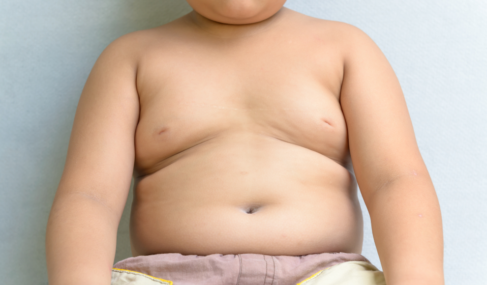 Junge mit Übergewicht