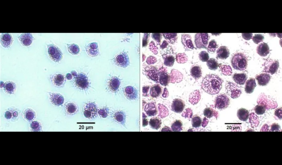 Die erzeugten Makrophagen-ähnlichen Zellen (links) ähneln stark den menschlichen Alveolarmakrophagen, die durch Lungenwaschungen gesammelt wurden (rechts)