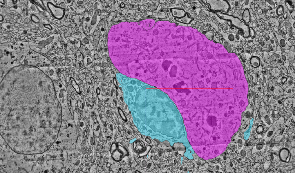 Detailliertestes 3D-Computermodell des Gehirns 