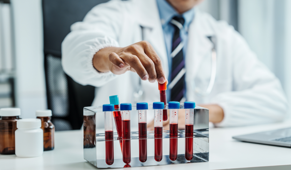 Bluttest erkennt Multiple Sklerose (MS) lange vor den ersten Symptomen