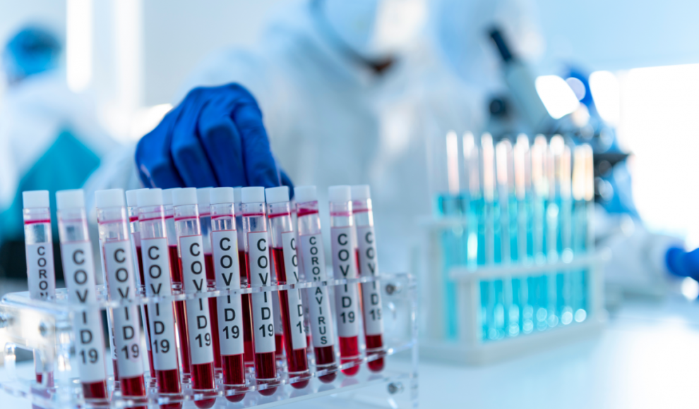 Künstliche Intelligenz (KI) entwirft Lipid-Nanopartikel (LNPs) für mRNA-Impfstoffe