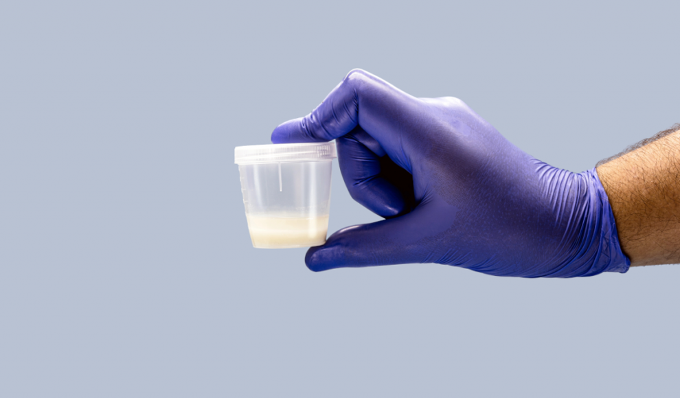 Analyse einer Spermaprobe