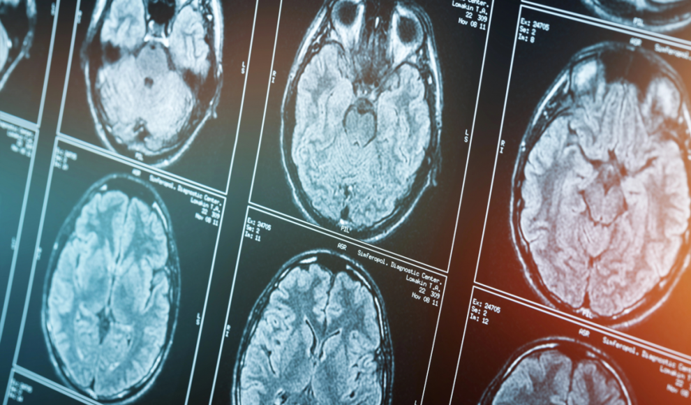 Doppelmoral ist im Gehirn sichtbar