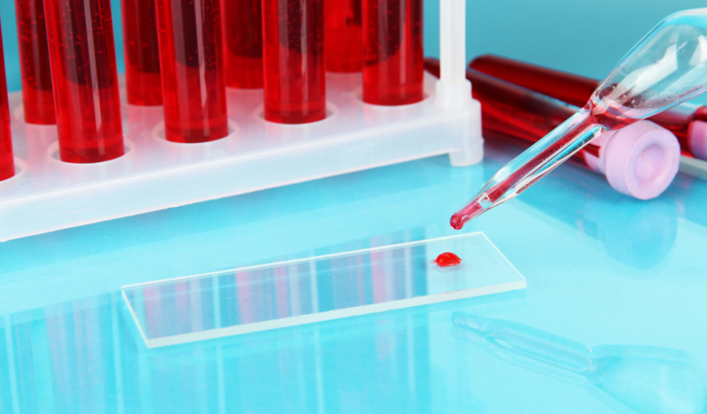 CO₂-Konzentration beeinflusst Blutwerte des Menschen