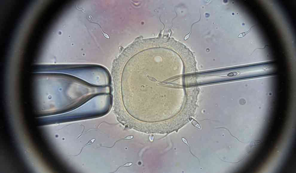Erfolg der künstliche Befruchtung hängt offenbar von zwei Bakterien ab