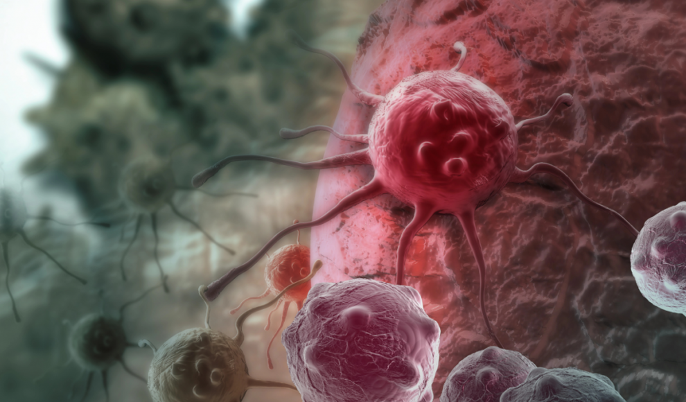 Familienstand beeinflusst das Krebsrisiko stark