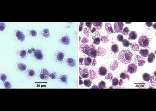 Durchbruch Für Die Medizin Ganzhirn Im Labor Gezüchtet Die Erforschung Komplexer Hirnerkrankungen Steht Vor Einem Wendepunkt - wwd6f4e