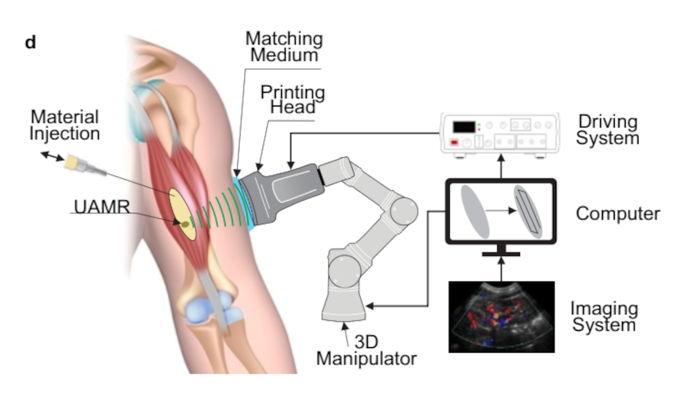 Direct Sound Printing (DSP)