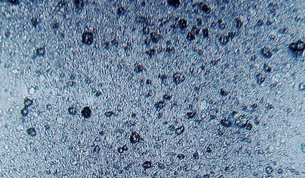 Mikroplastik